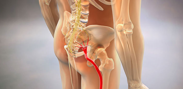 Sciatic nerve pain before chiropractic treatment from Minnetonka chiropractor