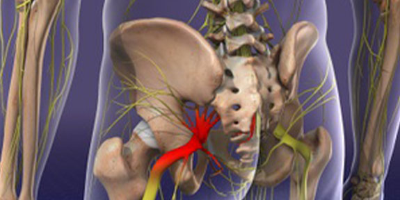 Sciatica Care Minnetonka